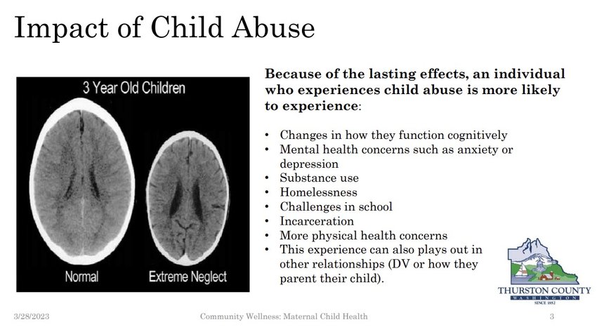 A comparison of the brains of 3-year-old children who experienced normal childhood and who experienced an abusive environment.
