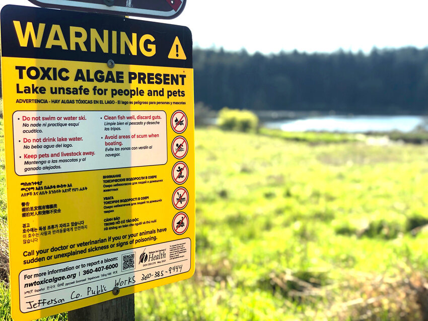 A lakeside sign warns visitors about a toxic algae bloom at Anderson Lake. With temperatures warming, county health officials have begun weekly monitoring at area lakes.